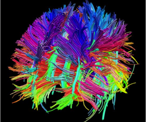 Human brain mapped with diffusion tensor imaging. CREDIT: COURTESY OF THE LABORATORY OF NEURO IMAGING AND MARTINOS CENTER FOR BIOMEDICAL IMAGING, WWW.HUMANCONNECTOMEPROJECT.COM