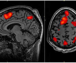 An fMRI scan highlights which portions of the brain are engaged in an activity or process.